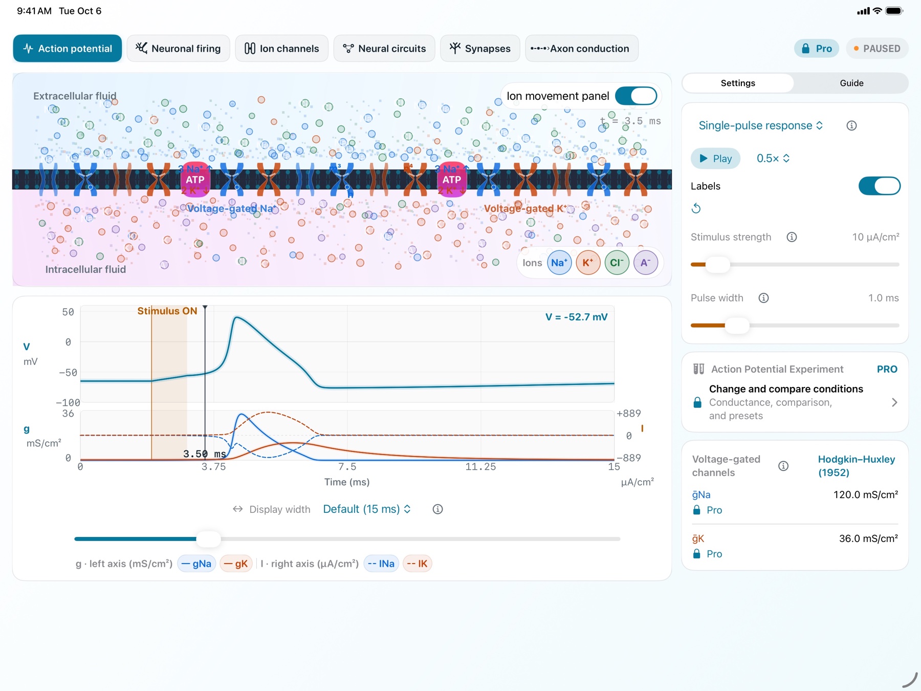 NeuroPhysMatrix Action potential screen on iPad