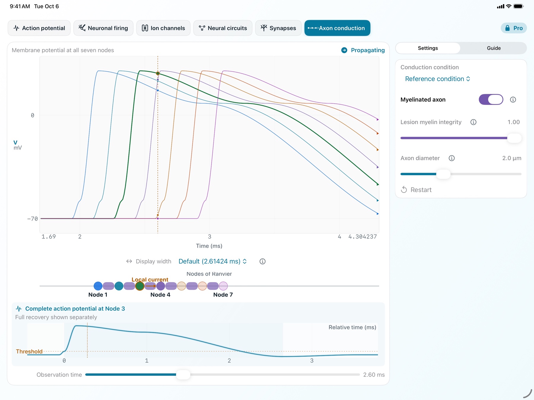 NeuroPhysMatrix Axon conduction screen on iPad