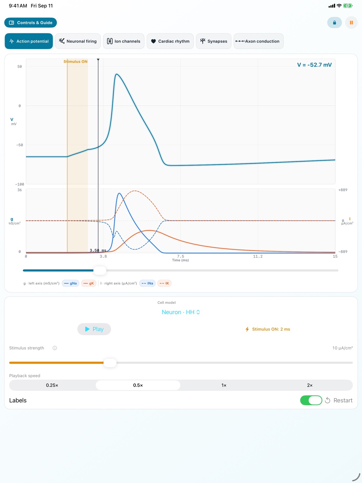 iPad Action Potential screen showing voltage, sodium and potassium conductance, and current on one timeline