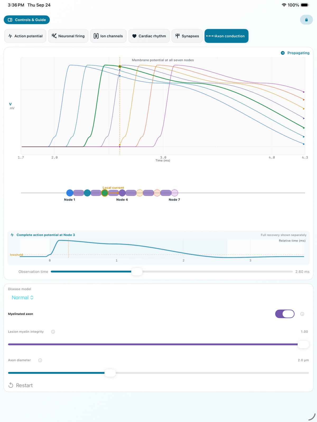 iPad Axon Conduction screen showing waveforms at seven nodes alongside an axon diagram