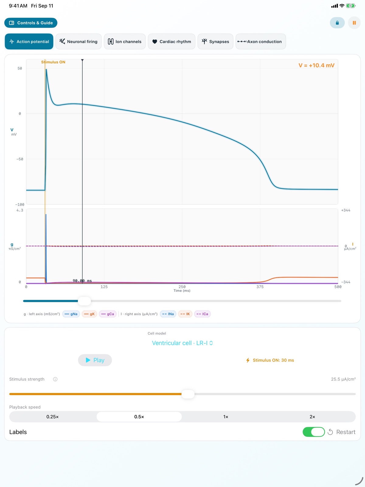 iPad Cardiac Rhythm screen showing conduction from the sinus node to the ventricles and waveforms from each site