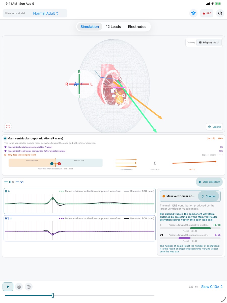 Two-lead waveform breakdown in ECG Vector for iPad