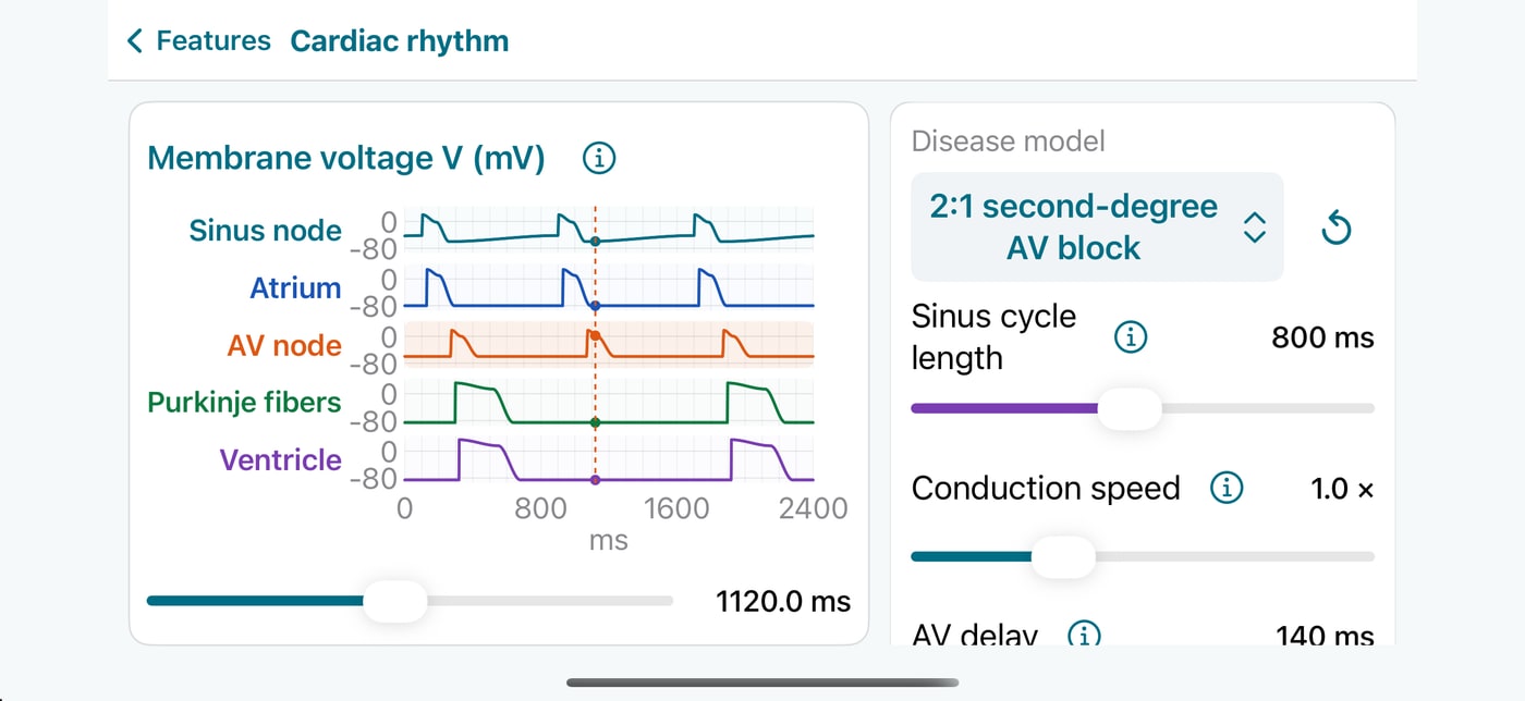 Cardiac Rhythm on iPhone showing regional membrane voltages and activation timing