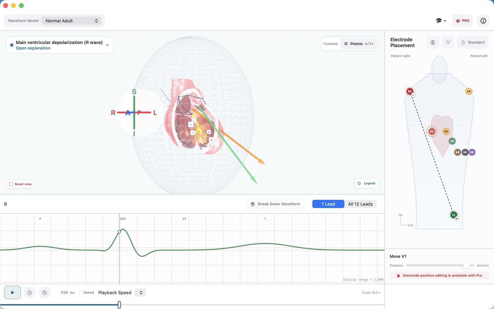 ECG Vector for Mac showing the 3D heart, lead axis, and synchronized waveform