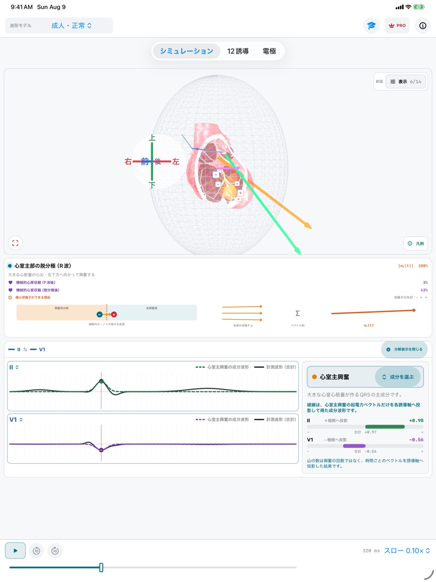 iPad版ECG Vectorの2誘導波形分解画面