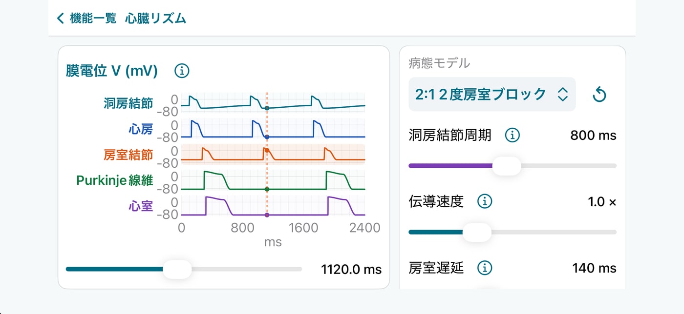 iPhone版の心臓リズムで、各部位の膜電位と興奮のタイミングを表示している画面