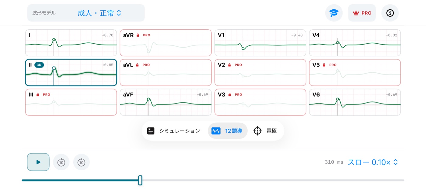 iPhone版ECG Vectorの12誘導一覧画面