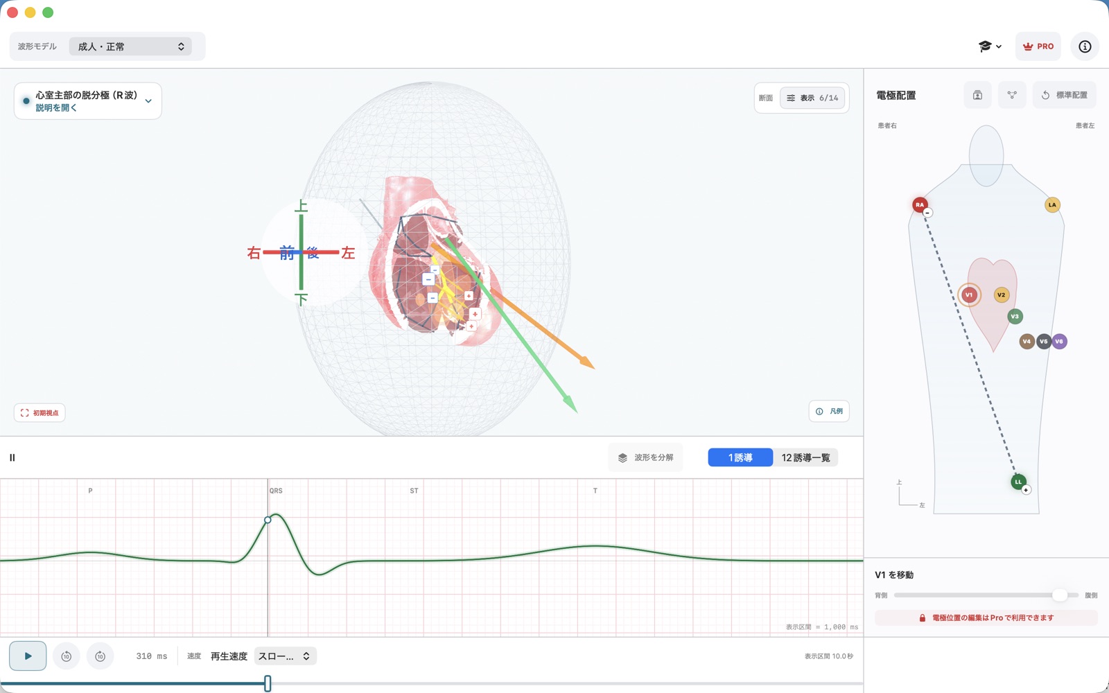 Mac版ECG Vectorで3D心臓、誘導軸、波形を表示している画面